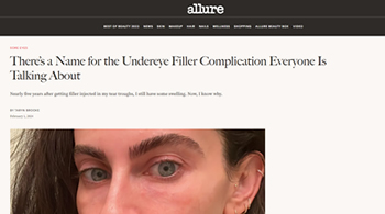 There’s a Name for the Undereye Filler Complication Everyone Is Talking About Beverly Hills, CA