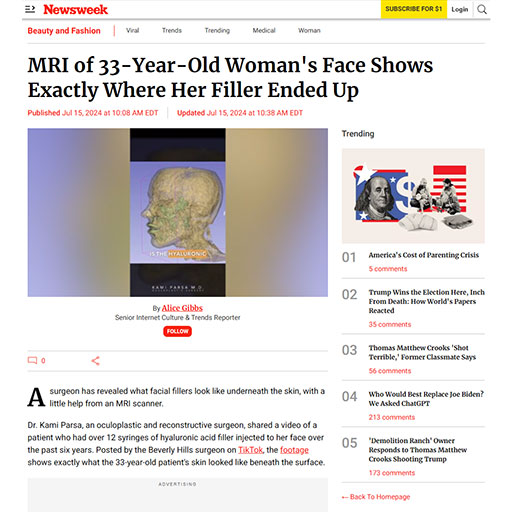 MRI of 33-Year-Old Woman's Face Shows Exactly Where Her Filler Ended Up Beverly Hills, CA